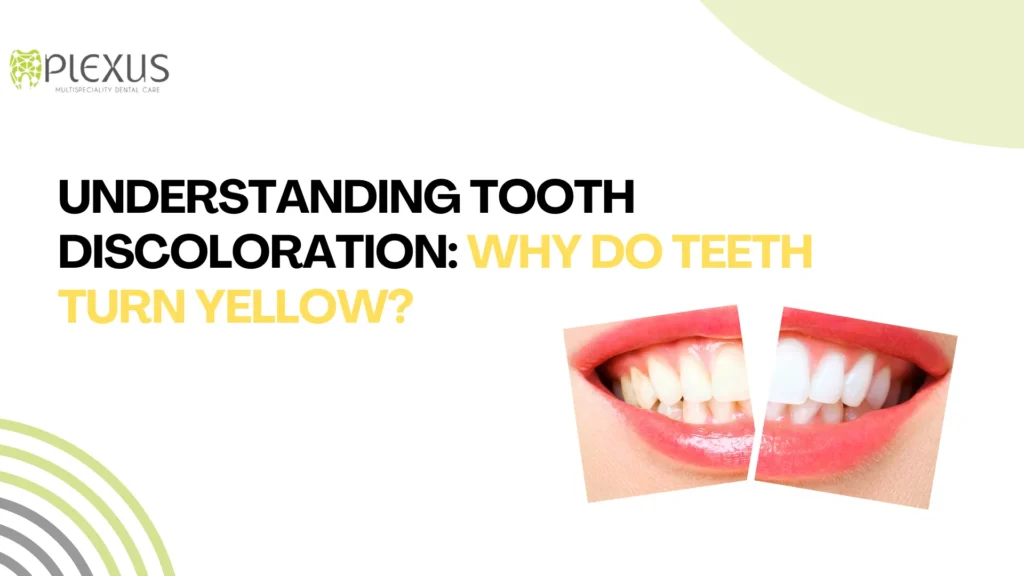 What Makes Teeth Yellow? A Smile Expert Explains the Causes and Solutions | Plexus Dental Studio