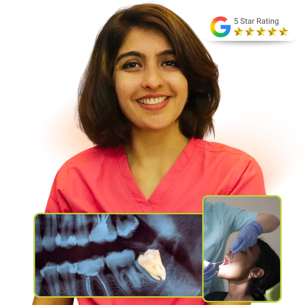 Wisdom tooth extraction by Dr. Esha in Andheri West