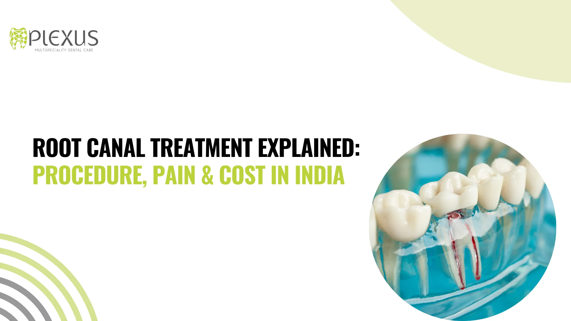 Root Canal Treatment Explained Procedure