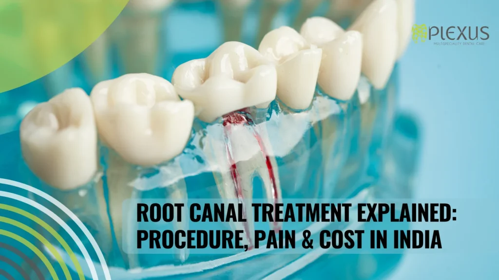 Root canal treatment-Plexus
