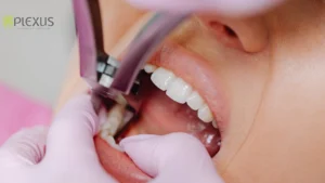Tooth removal | Plexus dental studio