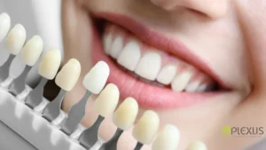 Whitening your teeth | Plexus dental studio