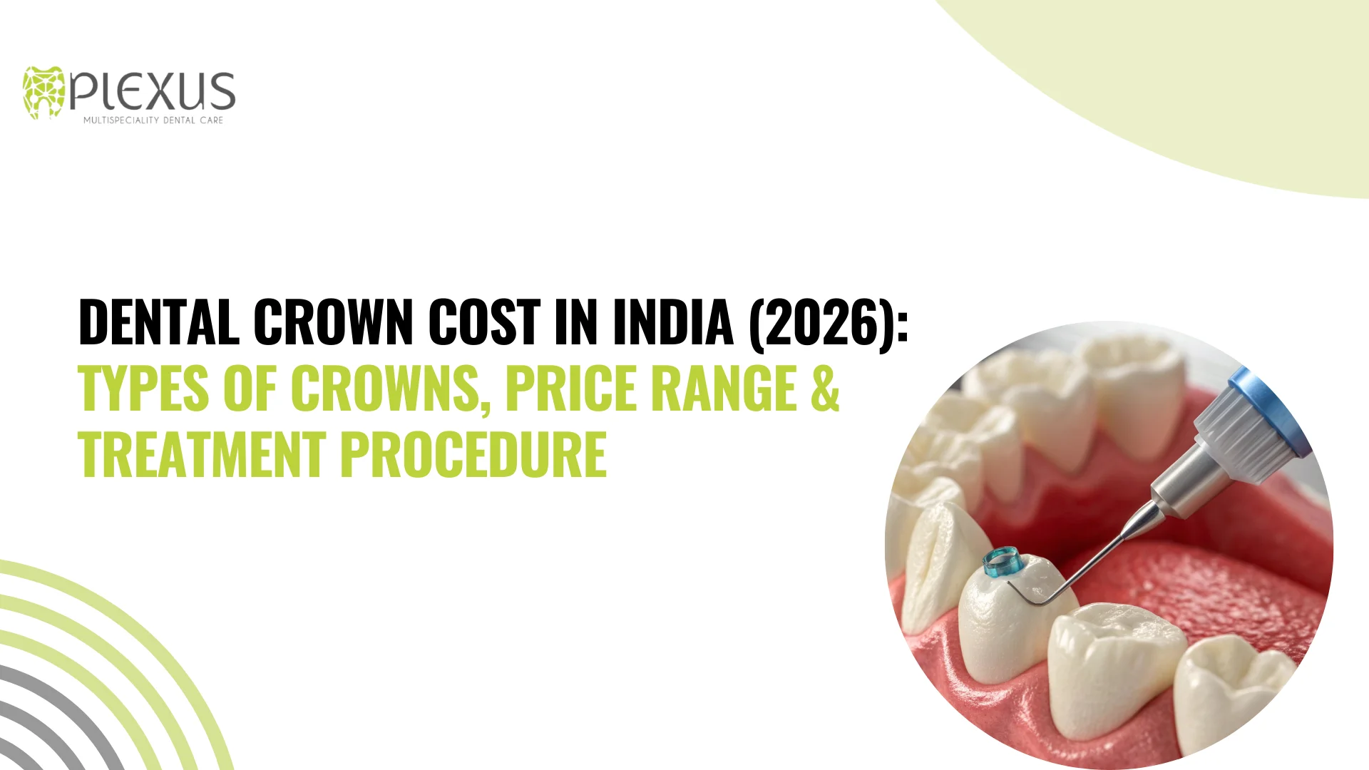 Dental Crown Cost in India