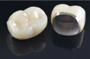 Dental Crowns