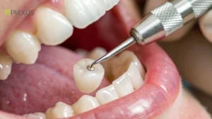 Plexus dental studio - dental crown price