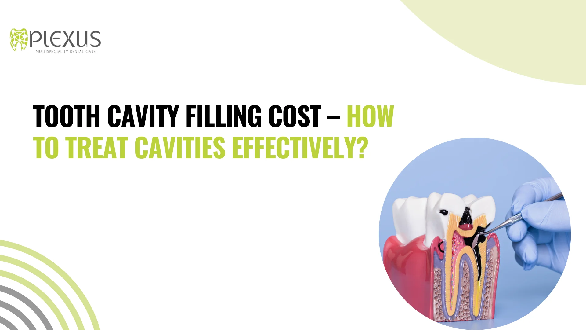 Tooth Cavity cost Mumbai