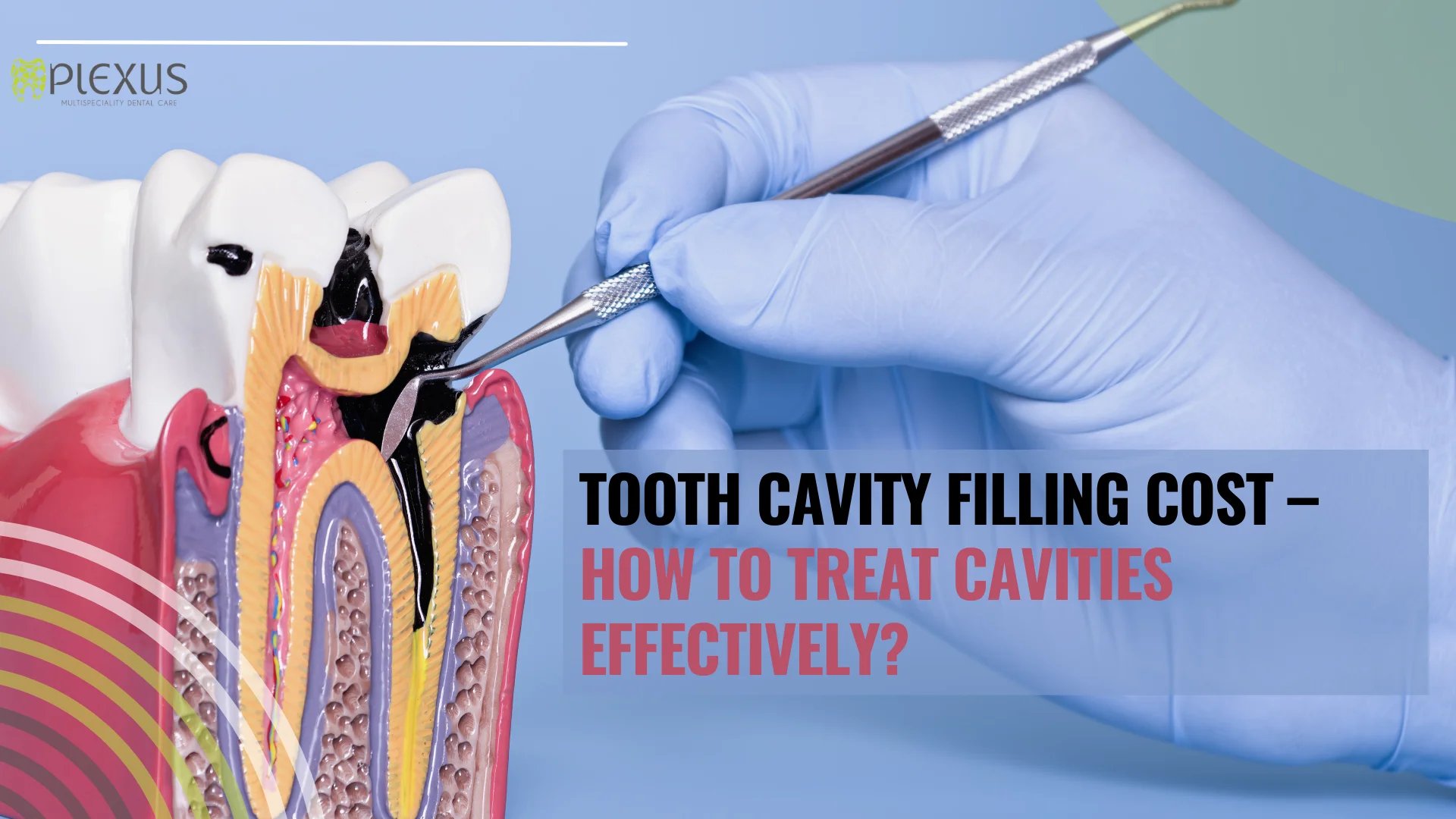 Tooth cavity filling cost- How to treat cavities effectively