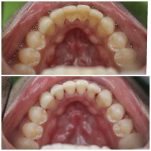 gum disease treatment Mumbai