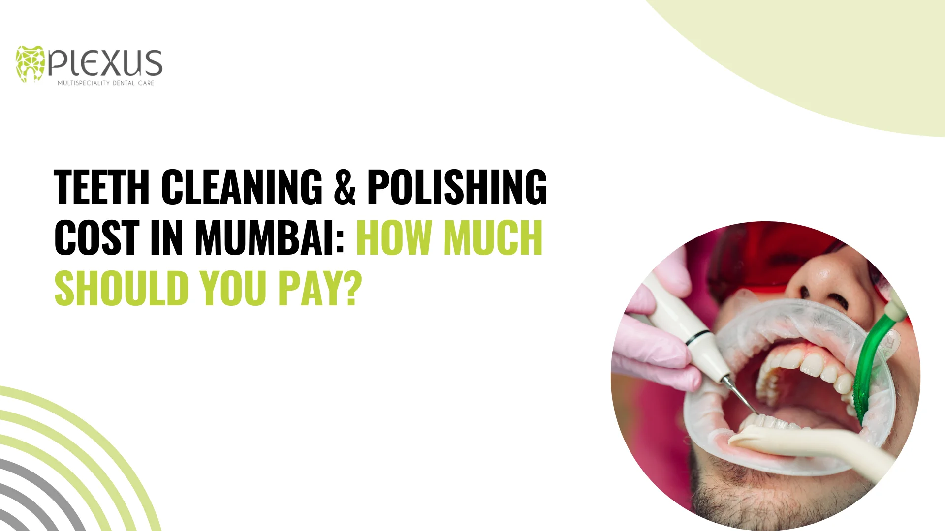 Teeth Cleaning & Polishing Cost in Mumbai