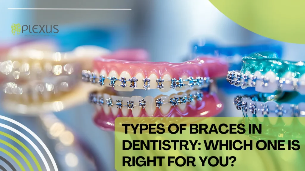 Types of Braces in Dentistry Which One Is Right for You