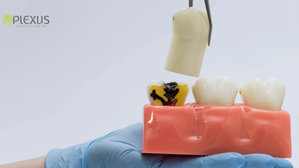 Causes Of Tooth Infection