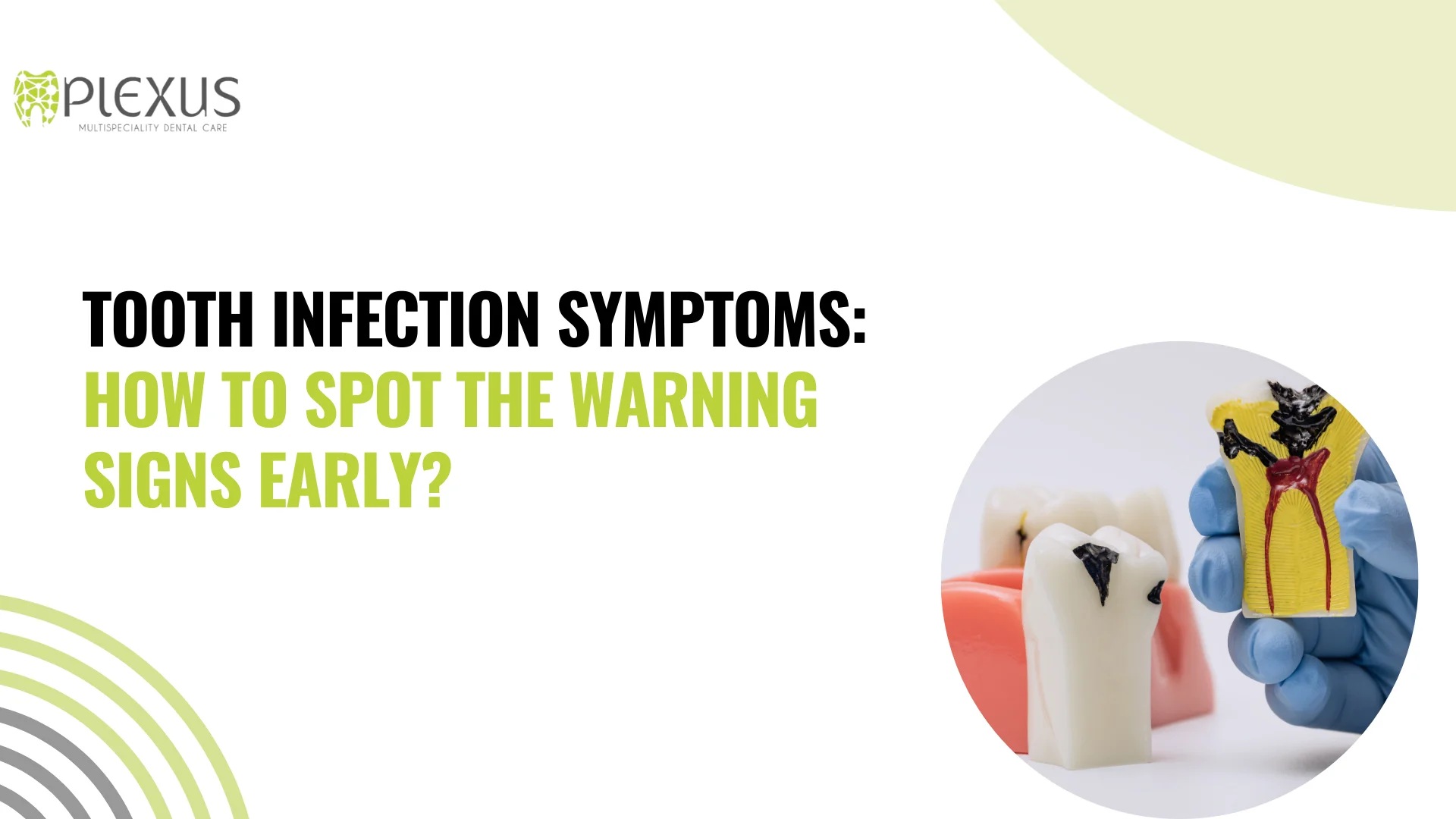 Causes Of Tooth Infection - Plexus