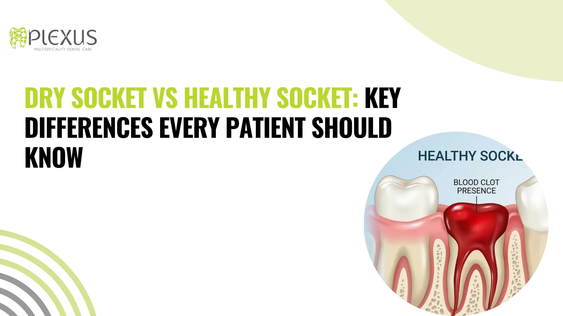 Dry Socket vs Healthy Socket Key Differences Every Patient Should Know