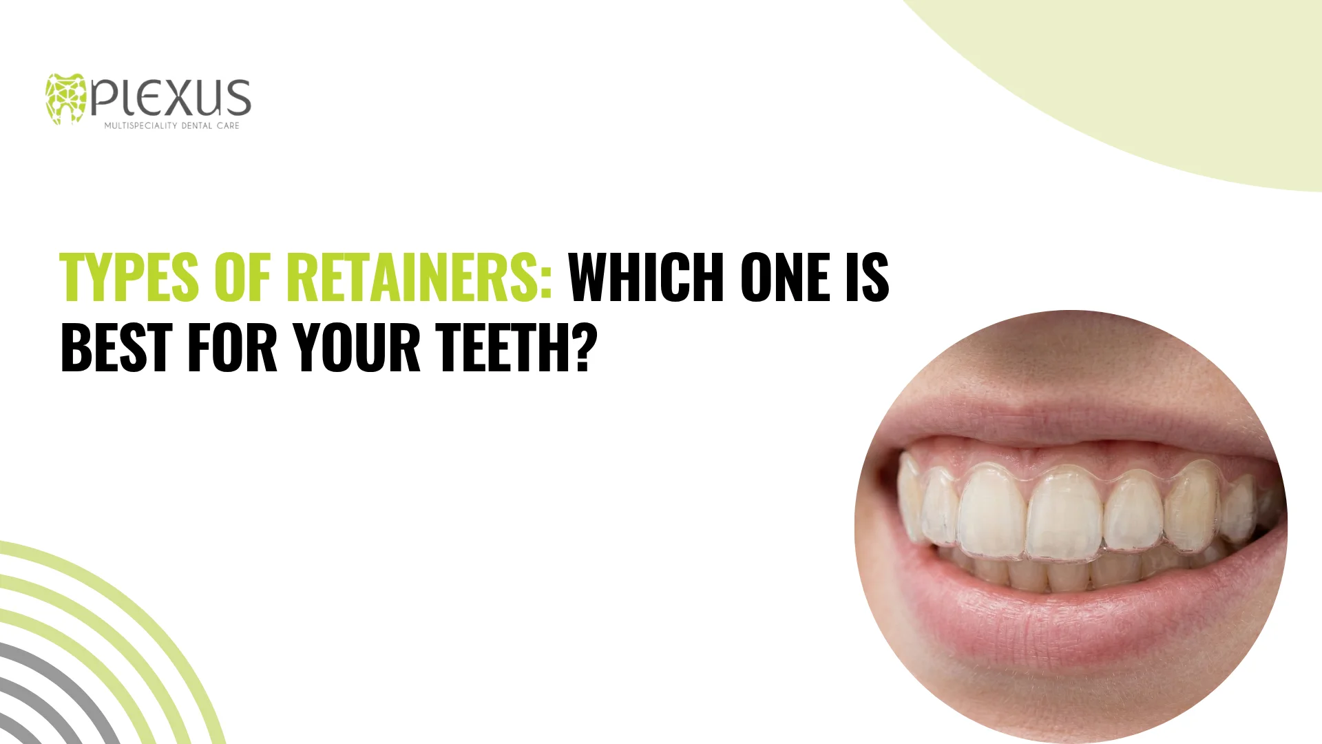Types of Retainers Which One Is Best for Your Teeth