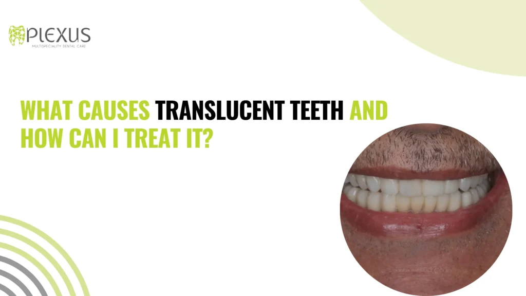 What causes translucent teeth and how can I treat it?