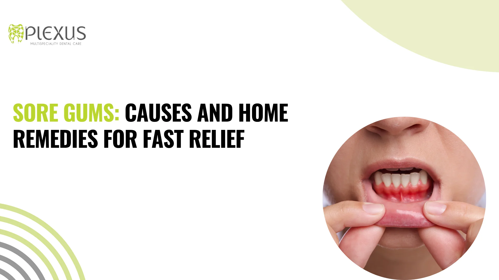 Sore Gums Causes and Home Remedies for Fast Relief.