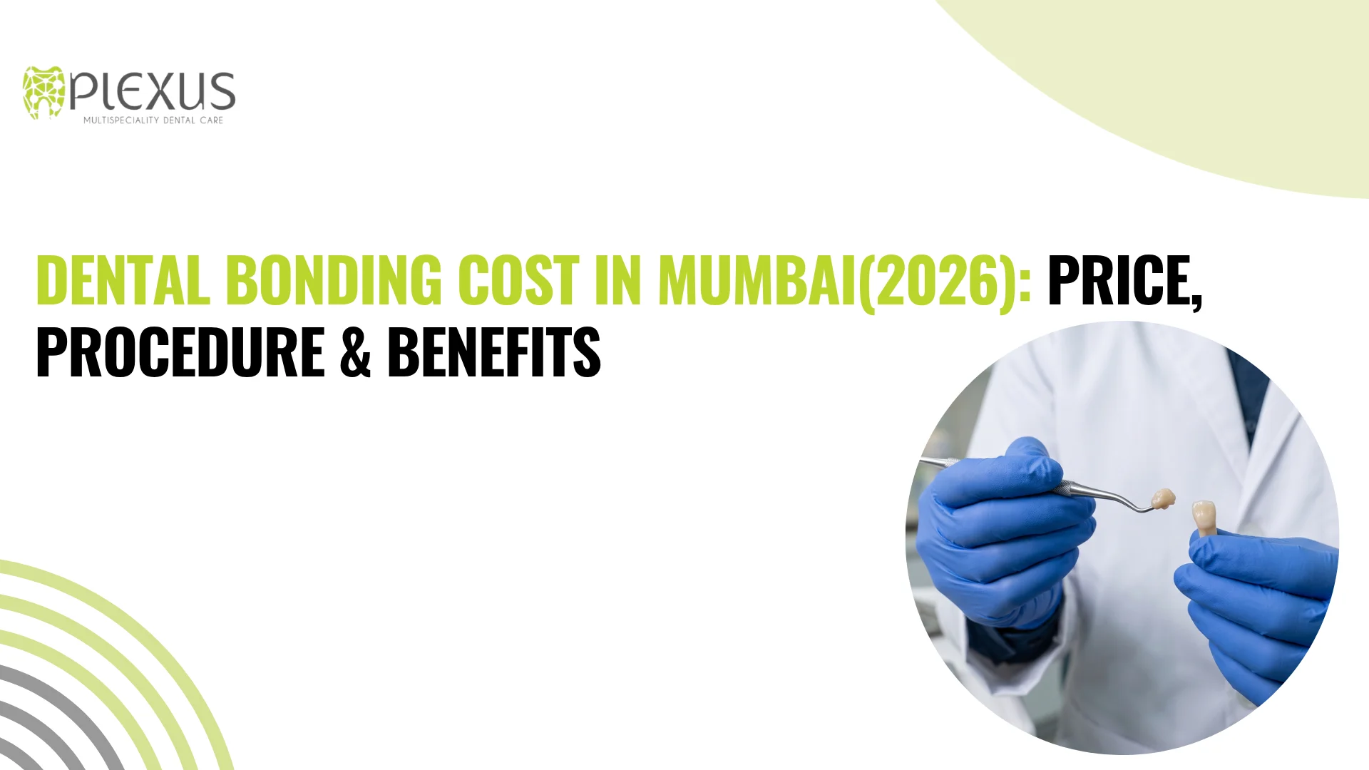 Dental Bonding Cost in Mumbai(2026) Price, Procedure & Benefits