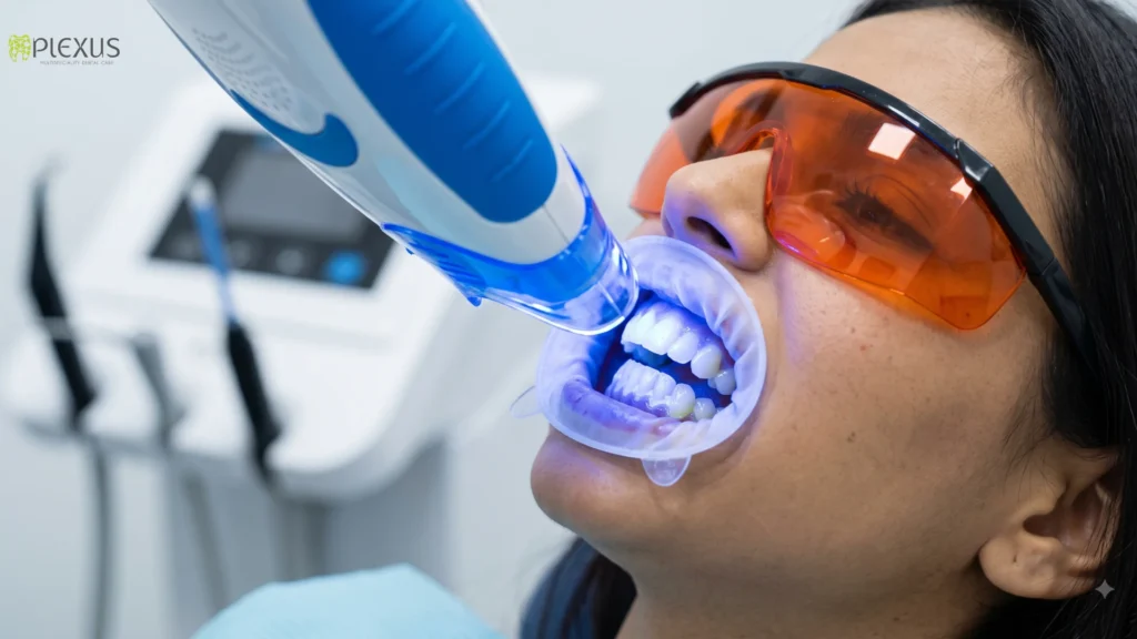 Teeth bleaching Cost In Mumbai