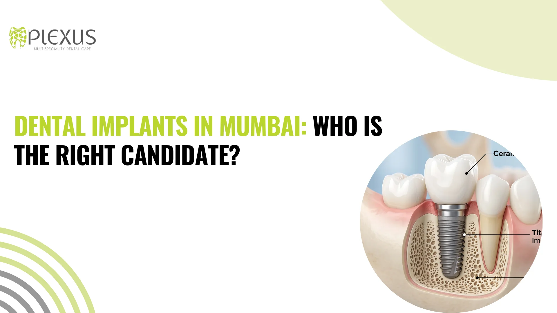Dental Implants in Mumbai Who Is the Right Candidate