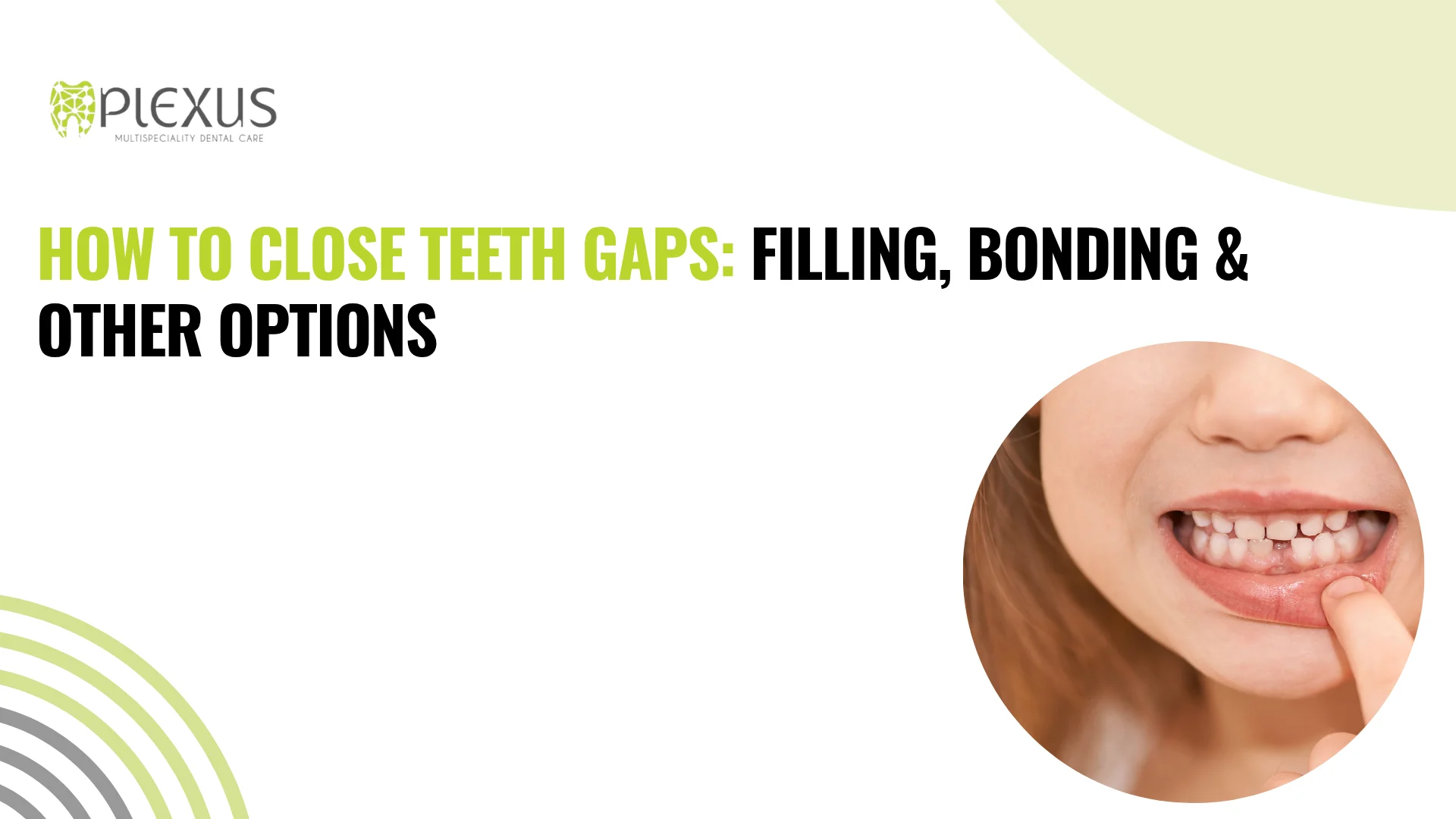 How to Close Teeth Gaps Filling, Bonding & Other Options