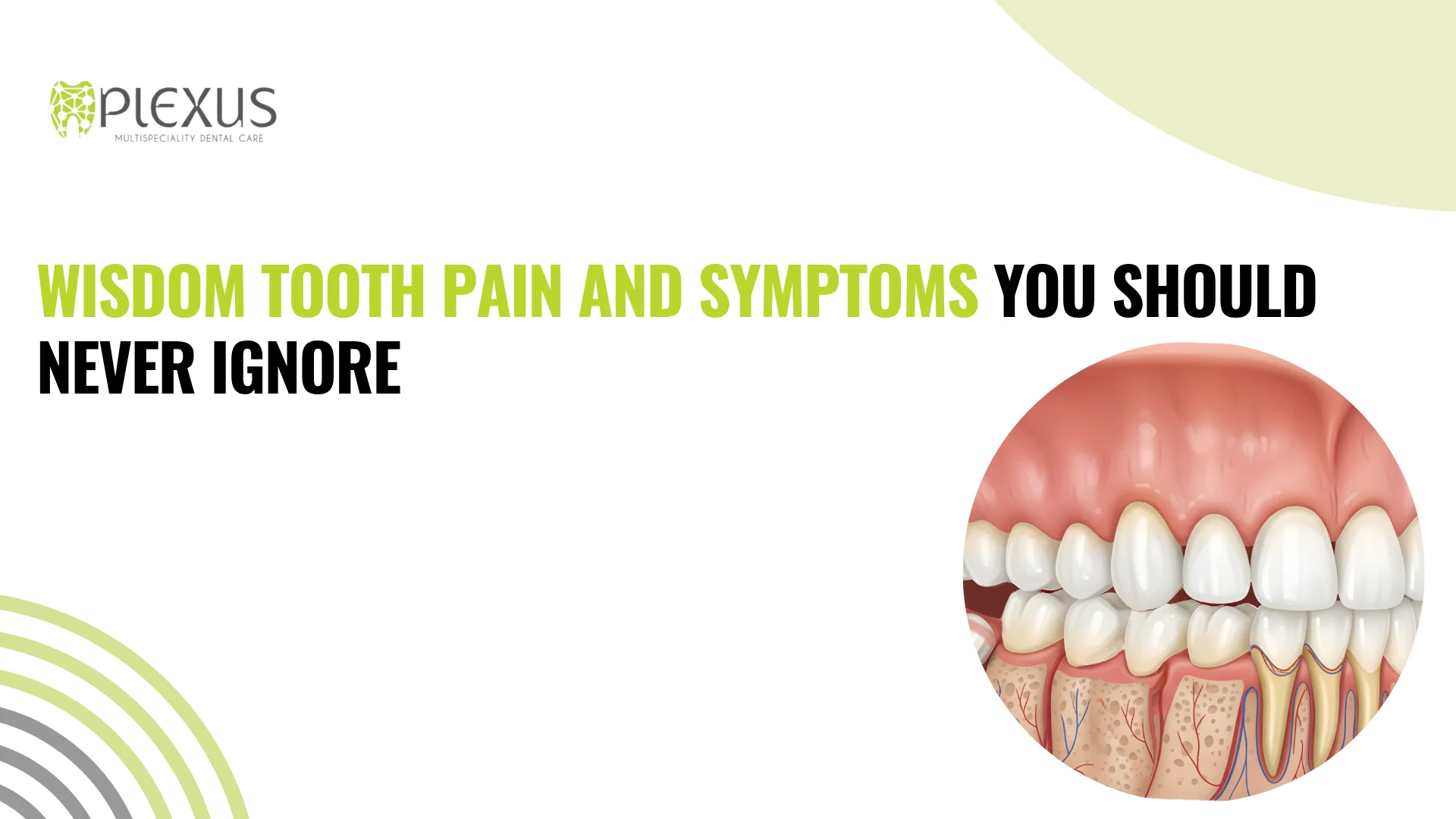 Wisdom Tooth Pain and Symptoms You Should Never Ignore