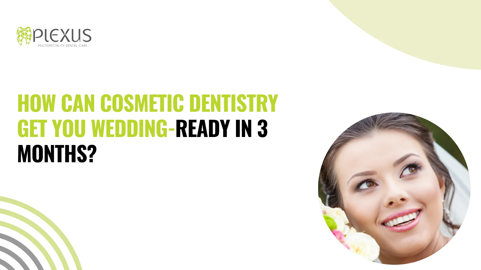 wedding smile makeover