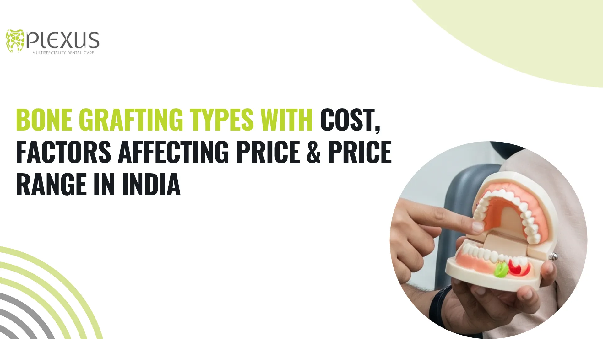 Bone Grafting Types with Cost, Factors Affecting Price & Price Range in India