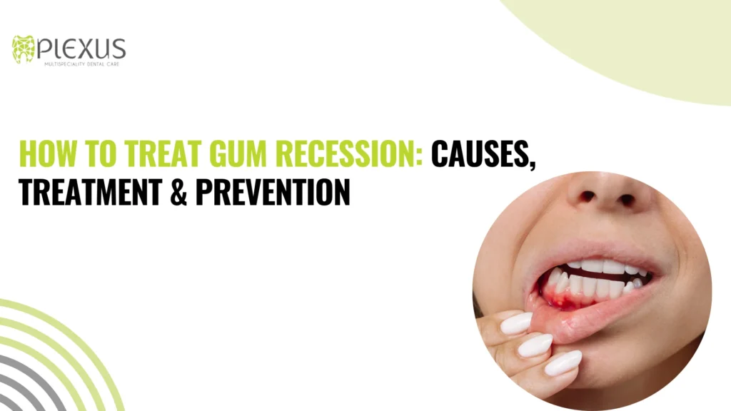 How to Treat Gum Recession Causes, Treatment