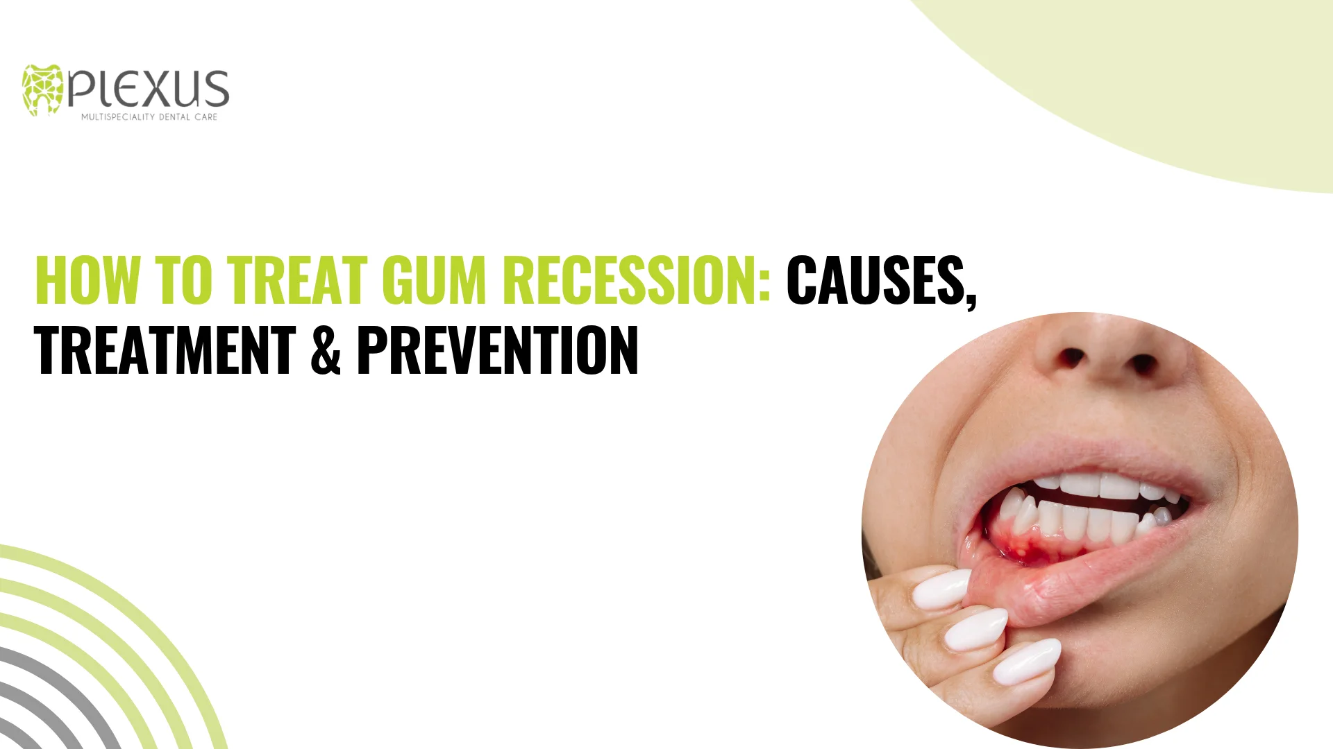 How to Treat Gum Recession Causes, Treatment
