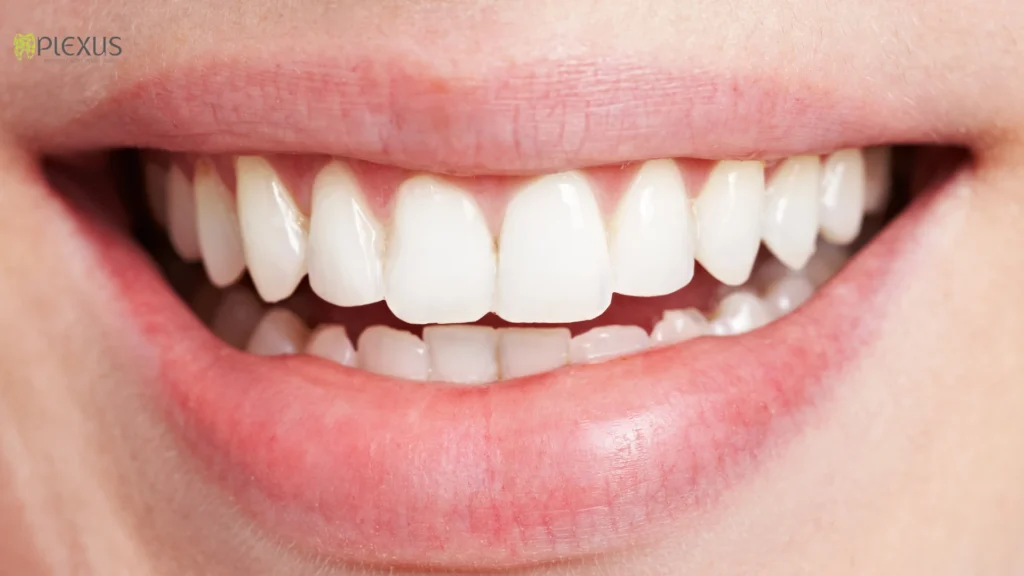 What Is a Smile Makeover